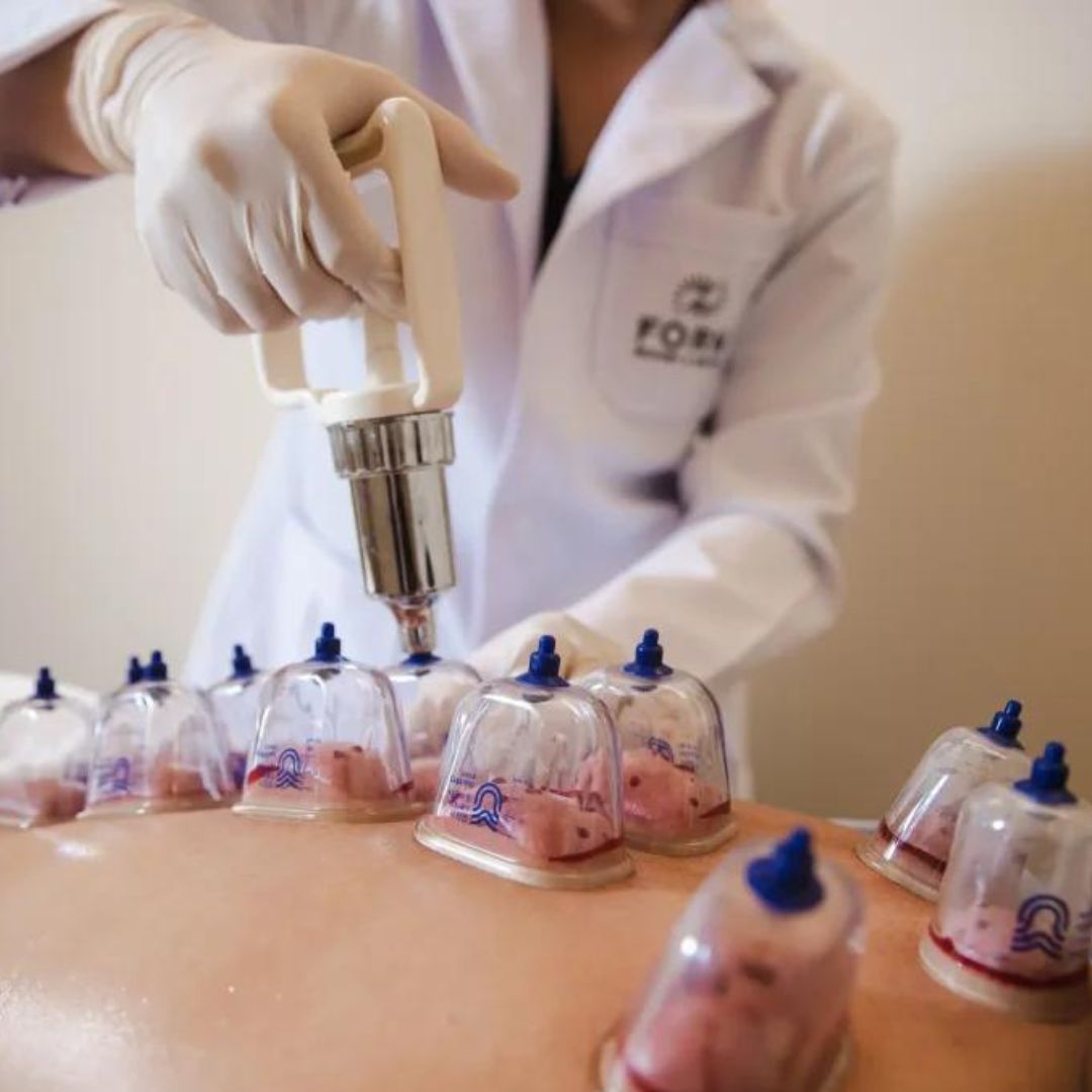 Best acupuncture clinic