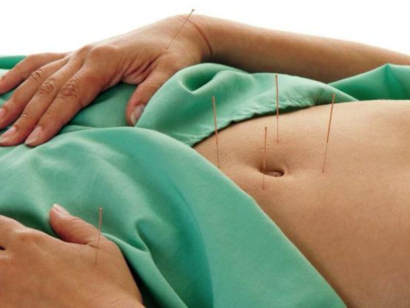 Acupuncture for wellness