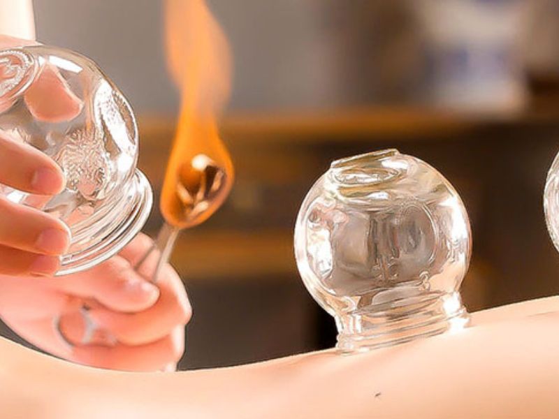 Acupuncture for migraines